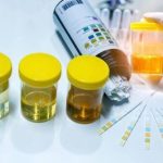 Νιτρώδη στα ούρα